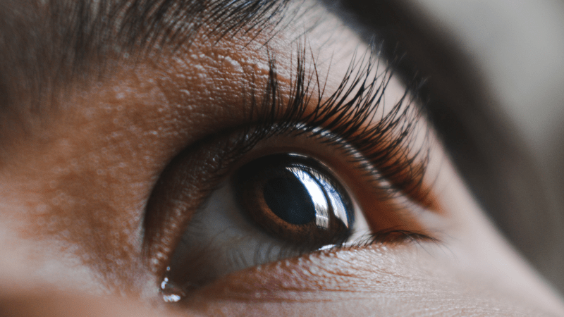 El ojo vago: síntomas, prevención y tratamientos - Clínica El Brillante