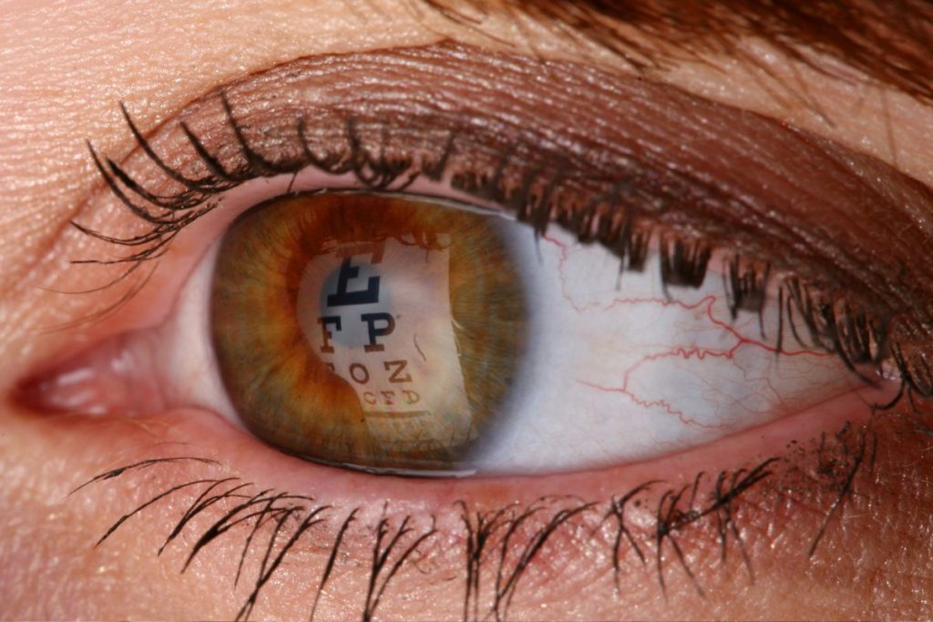 Consejos para postoperatorio de desprendimiento de retina - Clinica El Brillante
